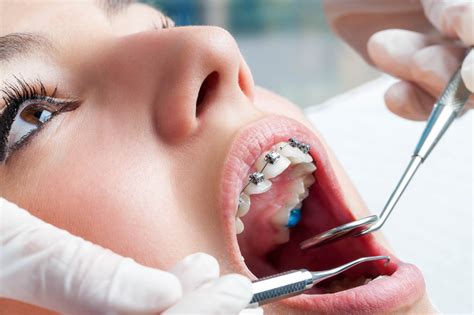 Complicated Tooth Extractions In Waterloo