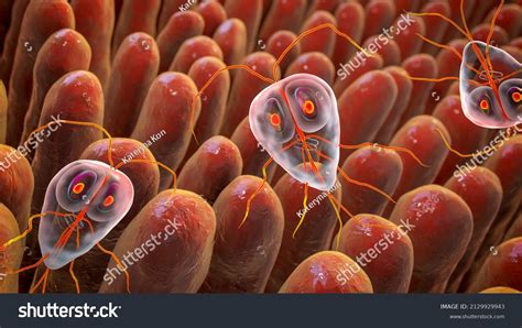 1653 Imágenes De Infección Intestinal Por Parásitos Imágenes Fotos Y Vectores De Stock