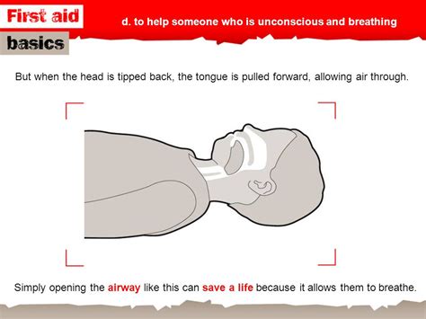 You Will Learn A To Consider Why It Is Important To Learn First Aid B