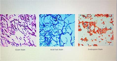 Solved Gram Stain Acid Fast Stain Endospore Stain UNKNOWN Chegg