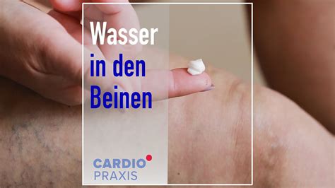 Beinödeme Wasser in den Beinen Cardiopraxis