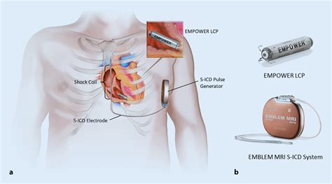 The Modular Cardiac Rhythm Management System The Empower Leadless