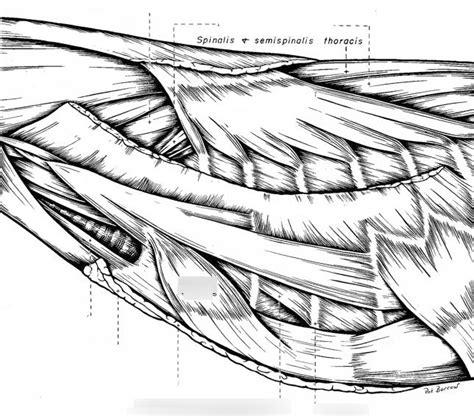 Hypaxial Muscles Of The Thoracic Wall Diagram Quizlet