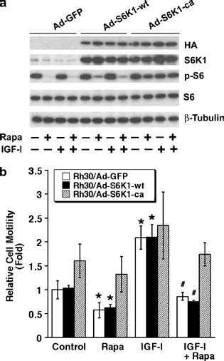 Rapamycin Inhibits Cell Motility By Suppression Of Mtor Mediated S6k1 And 4e Bp1 Pathways Oncogene