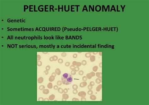 "Hypo"segmented neutrophil... | Hematology, Segmentation, Genetics