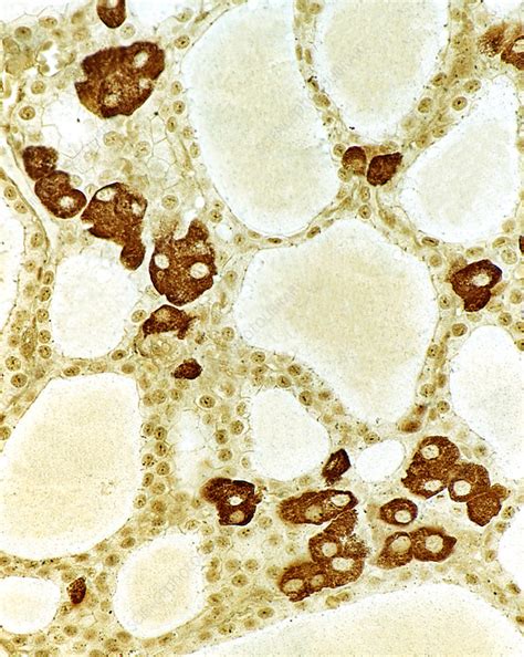 thyroid gland stock image p science photo library