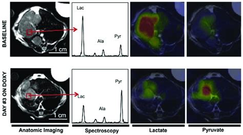 A representative example showing the application of hyperpolarized MRI ...