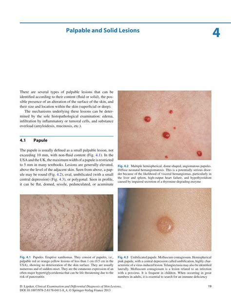 (PDF) Clinical Examination and Differential Diagnosis of Skin Lesions ...