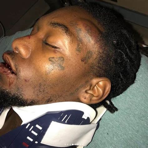 Offset 'could have died' in car crash as he shows off bloody injuries | Metro News