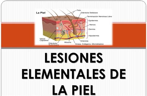 Lesiones Elementales De La Piel