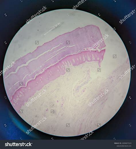 Photo Human Skin Tissue Under Microscope Stock Photo 2205877123 ...