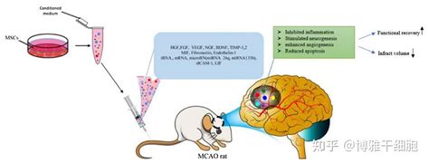 全球上百项临床开展中：间充质干细胞治疗脑卒中又有了新证据 知乎