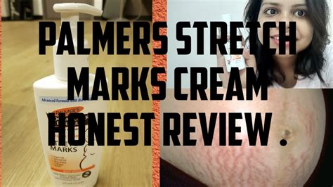 How To Get Rid Of Stretch Marks Palmers Stretch Marks Lotion Review