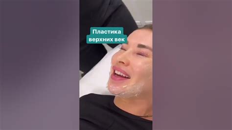 Швы после блефаропластики #блефаропластика #пластикавек #реабилитация # ...