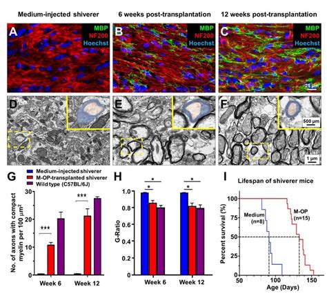 Compact Myelin In The Corpus Callosum And Lifespan Extension Of