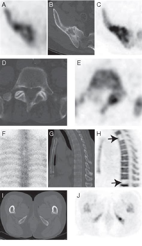 Figure From Prospective Study Evaluating The Relative Sensitivity Of