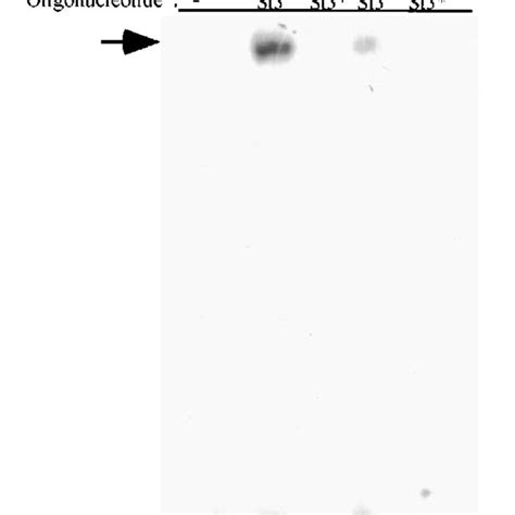 DNA Binding Activity Of STAT 3 In 32Dcl3 And 32D AMSrc Cells Nuclear