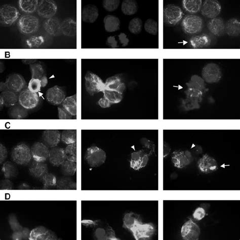 Bortezomib Induced Aggresome Formation And Lbh589 Induced ␣ Tubulin Download Scientific