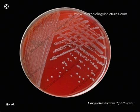 Corynebacterium Diphtheriae On Blood Agar Plate Bap Appearance Of C