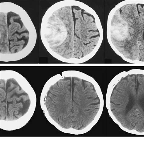 Preoperative Axial Computed Tomography Scans At Different Levels