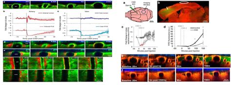 Frontiers Glymphatic System Dysfunction A Novel Mediator Of Sleep