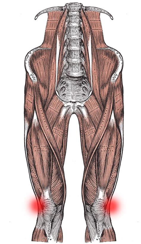 IT Band Syndrome Symptoms Causes And Treatment Exercises Martin Koban