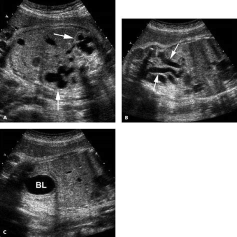 Genitourinary Tract Radiology Key