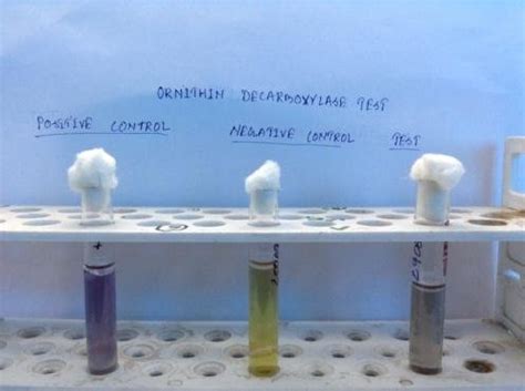 Ornithine Decarboxylase Test (Test Strain Positive) | Download Scientific Diagram