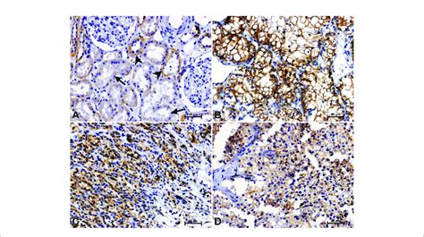 Positive B Catenin Immunostaining In Distal Arrowheads And Proximal