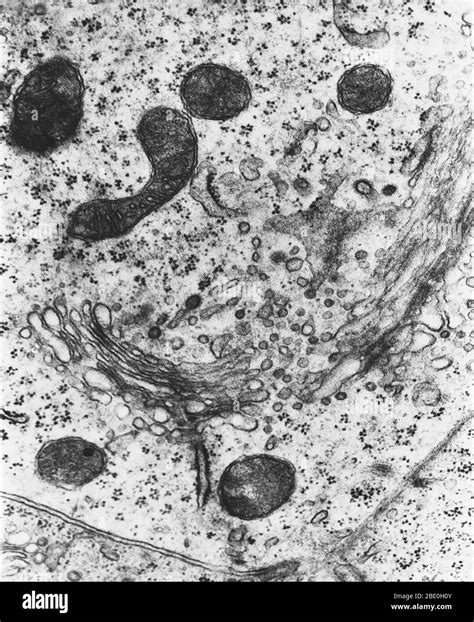 Micrografía electrónica de transmisión TEM de lisososomas Un