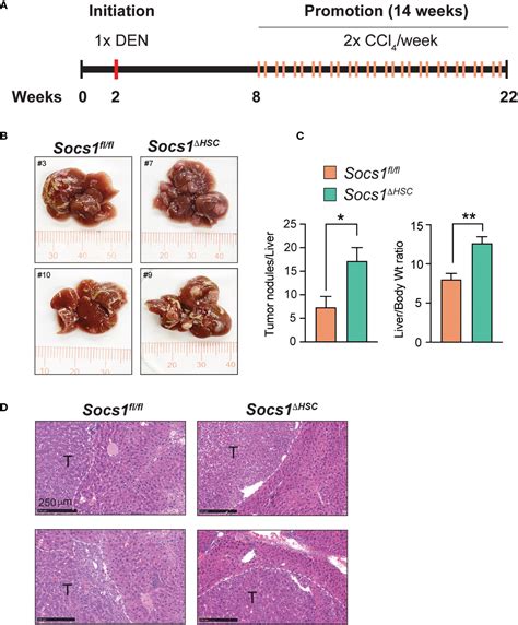 Frontiers Hepatic Stellate Cell Intrinsic Role Of SOCS1 In