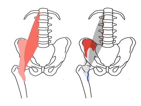 腸腰筋（ちょうようきん）の起始・停止と機能