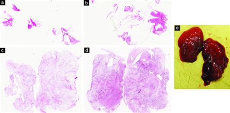 A D Histological Samples With Hematoxylin And Eosin Staining Of