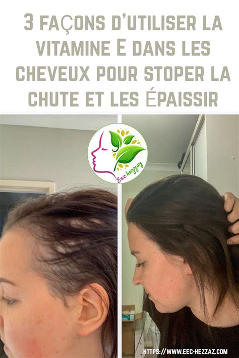 Vitamine E Et Cheveux Blancs