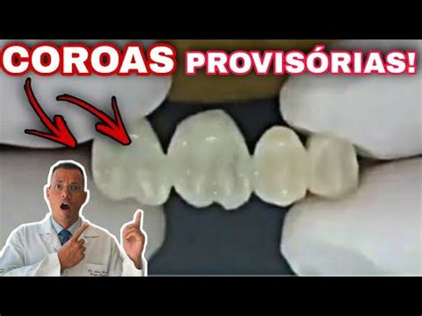 Veja como é feito o PROVISÓRIO no DENTISTA Passo a Passo YouTube