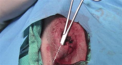 Open Technique For Anal Sacculectomy A Pair Of Closed Mosquito