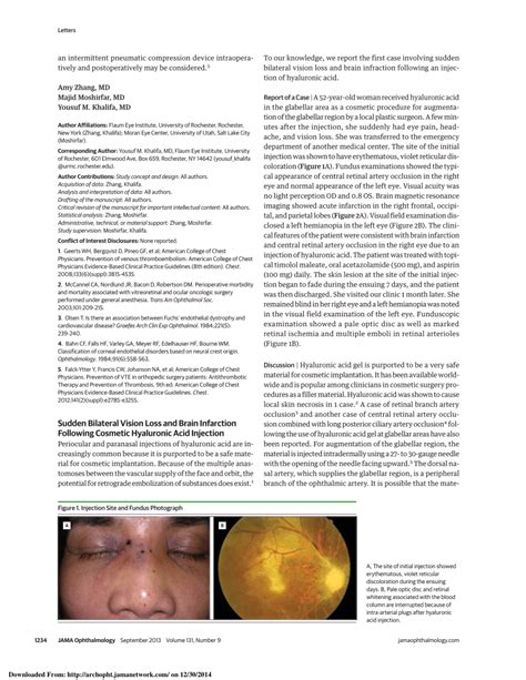 Pdf Sudden Bilateral Vision Loss And Brain Infarction Following