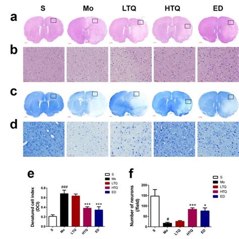 Protective Effect Of Thymoquinone In A Rat Model Of Cerebral Ischemia