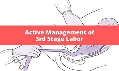 Active Management Of The Third Stage Of Labour With And, 45% OFF