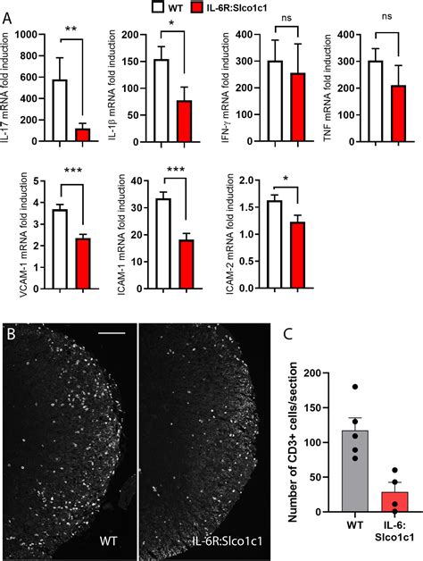 IL 6R Expressed On CNS Vascular Endothelial Cells Contributes To The