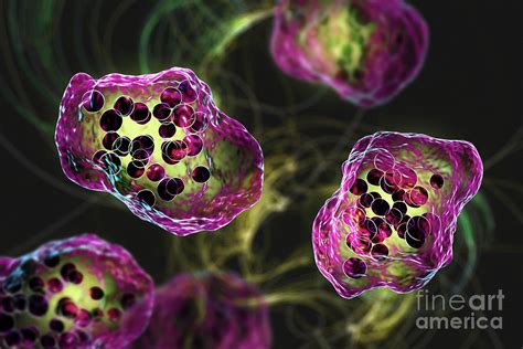 Measles Virus Infection Photograph By Kateryna Kon Science Photo