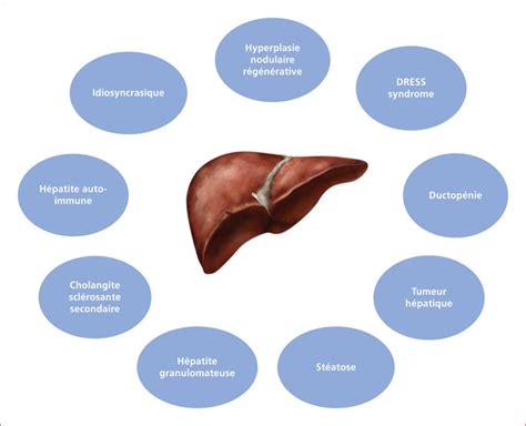 Jle H Pato Gastro Oncologie Digestive Les H Patites M Dicamenteuses