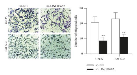 Linc Knockdown Inhibits The Malignant Phenotypes Of Os Cells A