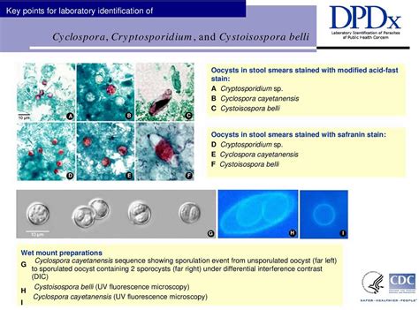 Cyclospora infections, symptoms, diagnosis, prevention, outbreak ...