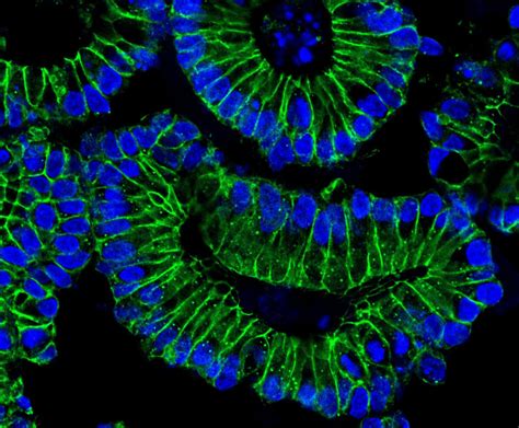 Colon Organoids Image Eurekalert Science News Releases