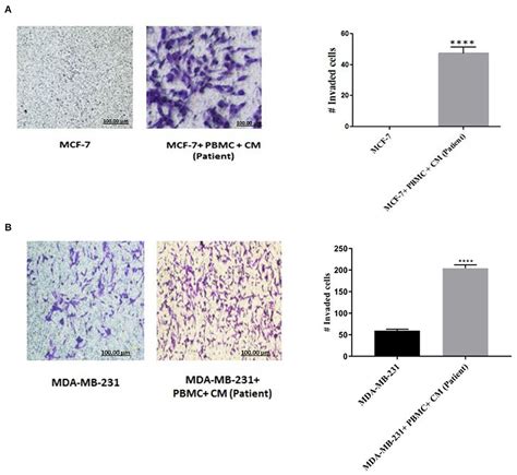 Frontiers Identification And Validation Of Stage Associated Pbmc