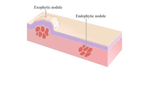 Lesiones Cutáneas Primarias y Secundarias pptx