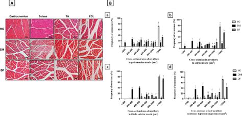 Histological Analysis Of Skeletal Muscles The Gastrocnemius Soleus