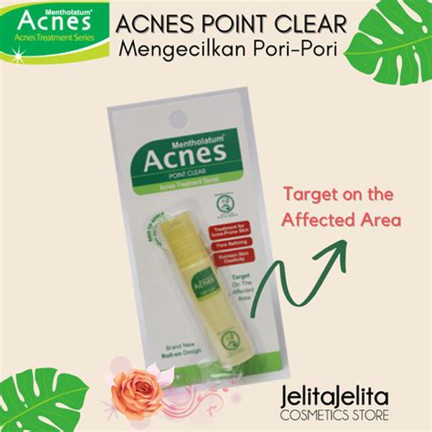 Jual Acnes Point Clear Roll On Penghilang Jerawat Cream Obat