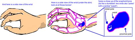 Scaphoid Fracture — Bone Talks